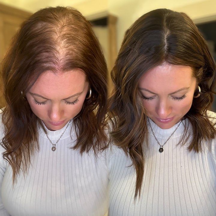 Volume Treatment